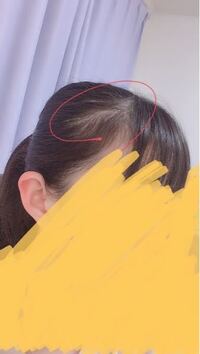 高2女子です 一部丸で囲んだ部分だけ髪の毛が薄いですやっぱ Yahoo 知恵袋