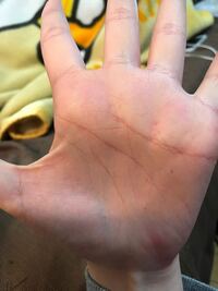 手相のky線を持っている芸能人を教えてくださいっ ガレッジセ Yahoo 知恵袋