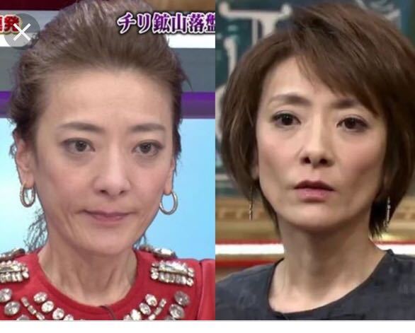 西川史子の激ヤセぶりは癌なんですか 拒食症ですか 美容整形のしすぎ Yahoo 知恵袋