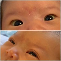 赤ちゃんの目が一重から二重に変わることはありますか 生後1ヶ月半の娘 Yahoo 知恵袋