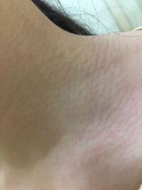 結構前から首辺りに肉割れのように変な横線が入っています 画像参照 Yahoo 知恵袋