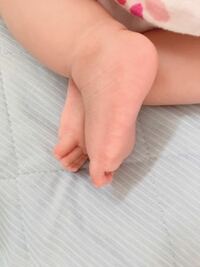 5ヶ月の赤ちゃん このように足をクロスします 起きてる時も寝て Yahoo 知恵袋
