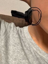 奥歯に虫歯があります フェイスラインにコリコリ動くしこりがあります Yahoo 知恵袋