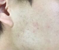 肌断食したら肌が綺麗になるってホントですか Yahoo 知恵袋