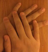 閲覧注意です 私は爪を噛む癖 指をポキポキ鳴らす癖 横爪 巻爪 Yahoo 知恵袋