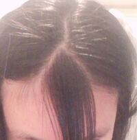 前髪の三角形 を小さくしたいです普通は上の写真のように三角形が広くて 大 Yahoo 知恵袋