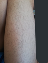 中学男子です 太ももから上の無駄毛 濃いですよね 別に背 Yahoo 知恵袋