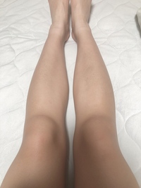 膝が大きくて悩んでいます 膝下にお肉みたいなものが付いていてつまめます Yahoo 知恵袋