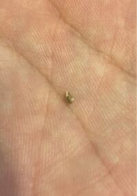 毎日奥歯をフロスしていて 親知らずも埋まっているところなのですが よくフ Yahoo 知恵袋