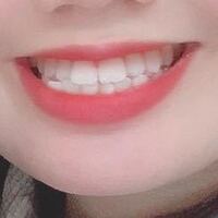 これって歯並び悪いですか １回矯正した歯並びです また2年半く Yahoo 知恵袋