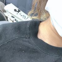 閲覧注意 フケの画像あります ５分ぐらい頭をかきむしったらこれだけフケがでまし Yahoo 知恵袋