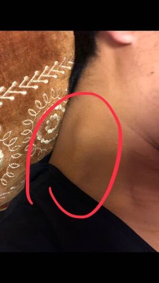 販売計画 ソフィー 複合 首 の しこり 風邪 Maoowwn Jp