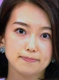 Nhkの和久田麻由子アナはどうしてホクロが多いのですか Yahoo 知恵袋