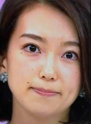 Nhkの和久田麻由子アナはどうしてホクロが多いのですか Yahoo 知恵袋