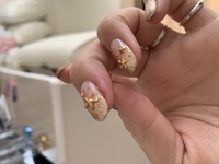 ネイルサロンでの怪我について至急教えてください 年末にネイルサロンを変え Yahoo 知恵袋