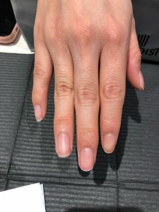 ネイル検定 モデル 爪 亀裂 ネイル検定 モデル 爪 亀裂 Potoapixnanjdi
