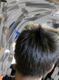 髪の毛量が人より多くてモサモサなのに頂点 つむじを中心に だけハゲ Yahoo 知恵袋