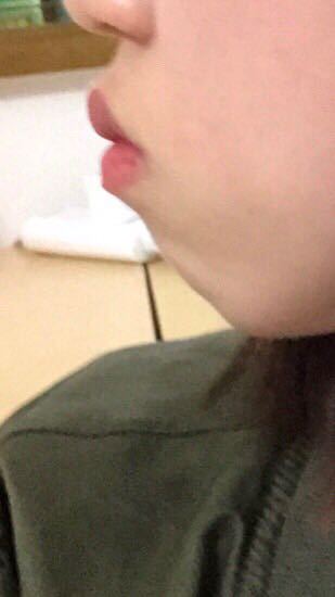 顎がへっこんでる というか ないんですよ モデルさんとかでも横顔でも Yahoo 知恵袋