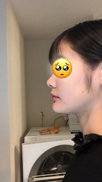 絶壁 しゃくれという コンプレックスだらけの横顔を何とかしたいです Yahoo 知恵袋