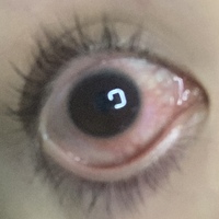 目の充血 痛みに効く市販の目薬はありますか 目の写真有ります Yahoo 知恵袋