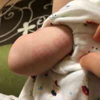 gの打つ位置についてお伺いしたいです 本日息子のbcgでした 帰宅し Yahoo 知恵袋