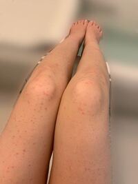 溶連菌になりペニシリン系の抗生剤を 飲んでいたのですが ア Yahoo 知恵袋