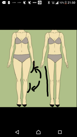 写真の左のように太もも付け根と膝の関節すぐ上がボコッと急に太く Yahoo 知恵袋