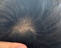 髪の毛の途中の白いぷちぷちなんですか そこを引っ張ると髪の毛が切れ Yahoo 知恵袋