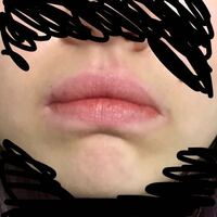肌の青っぽい部分を消すメイクについて教えてください 私は女なのですが 口 Yahoo 知恵袋