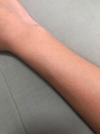 この汚い腕を綺麗にする方法ってありますか 私は汚いと思いませんが具体 Yahoo 知恵袋