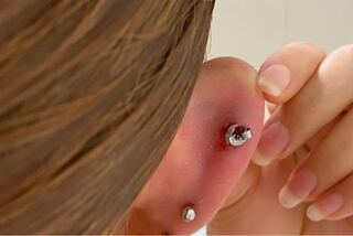 軟骨のピアスで ピアッサーで開けて 3月1日 ずっとファーストピアスのま Yahoo 知恵袋