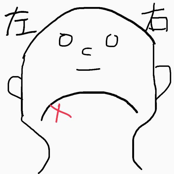 エラの下部分に 一円玉サイズ程度の丸いしこりがあります 画像 Yahoo 知恵袋