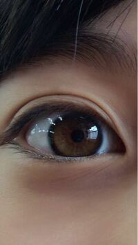 黒目の大きさについて 眼科医には 眼球そのものが人よりでかいと言われま Yahoo 知恵袋