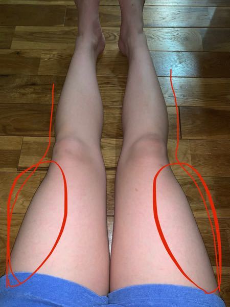 バレー部 太もも 