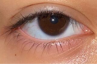 いろんな人に桃花眼 三白眼 ジト目 黒目の一部が変 と言われます Yahoo 知恵袋