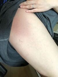 臨月です 体重が15キロ増加したのと横向きにしか眠れない Yahoo 知恵袋