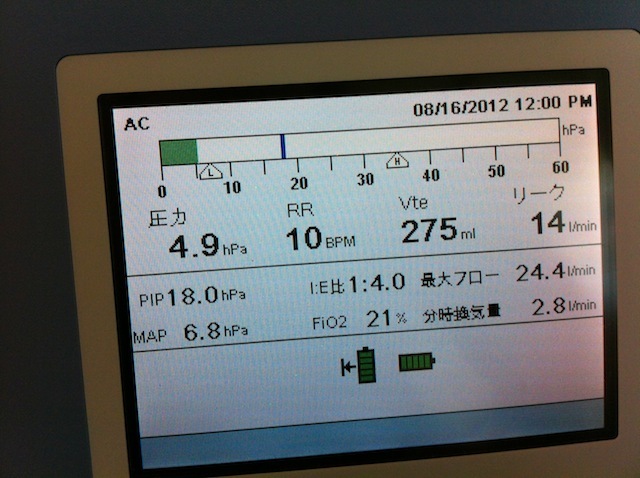 人工呼吸器のトリロジーで質問です 画面の横棒のメーターはリアルタイムの気 Yahoo 知恵袋