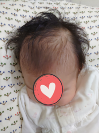 生まれたときから髪が長い赤ちゃん 髪の毛はいつ切りますか 生後 Yahoo 知恵袋