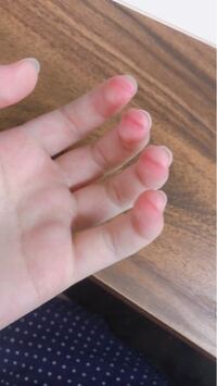 ギター弾き始めたのですがめちゃくちゃ指が痛いです こんなもんな Yahoo 知恵袋