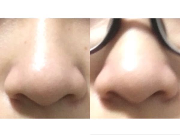メガネ付けると鼻が大きく見えますか？ - 大きく見えるってより 