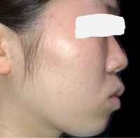 普段から無表情であまり笑わないことが多いからか 顔の脂肪が多かったり 口 Yahoo 知恵袋