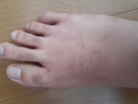 閲覧注意かも 女子だけどすごい毛が濃くて 足の指毛伸 Yahoo 知恵袋