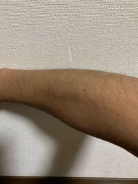 大学1年男です この腕毛は濃い方ですかね 回答お願いしま Yahoo 知恵袋
