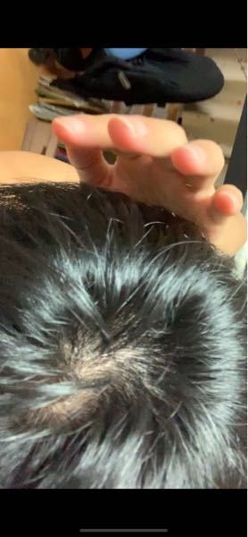 高校生です 光に当たったところを撮ったのですが これはハ Yahoo 知恵袋