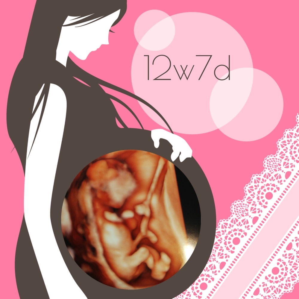 妊娠12週です ２回目の妊婦健診でのエコー写真ですが 頭の左側 Yahoo 知恵袋