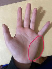右手の小指の下の部分の痛みについて 字を書く際に下に当たる小指の下 Yahoo 知恵袋