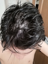 中一です 髪を濡らして書き上げたらこうなりました ハゲてますか Yahoo 知恵袋