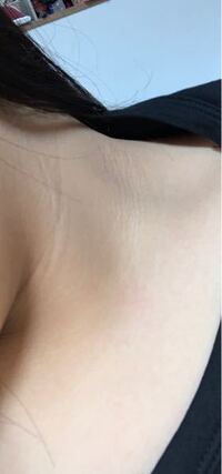 不快で申し訳ありません こーいった首の黒ずみはどうするべきでし Yahoo 知恵袋