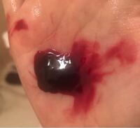 さっきお風呂で膣から血がでてきました どぅるっとしてて一塊になって Yahoo 知恵袋