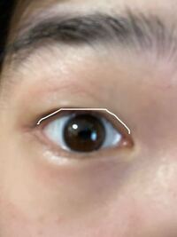 二重線が凄くおかしいです 昨日からいきなり瞼が下がってきて 目を見開くと Yahoo 知恵袋